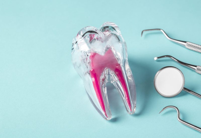 Dental care and treatment concept, tooth with dentist instruments on blue background, copy space