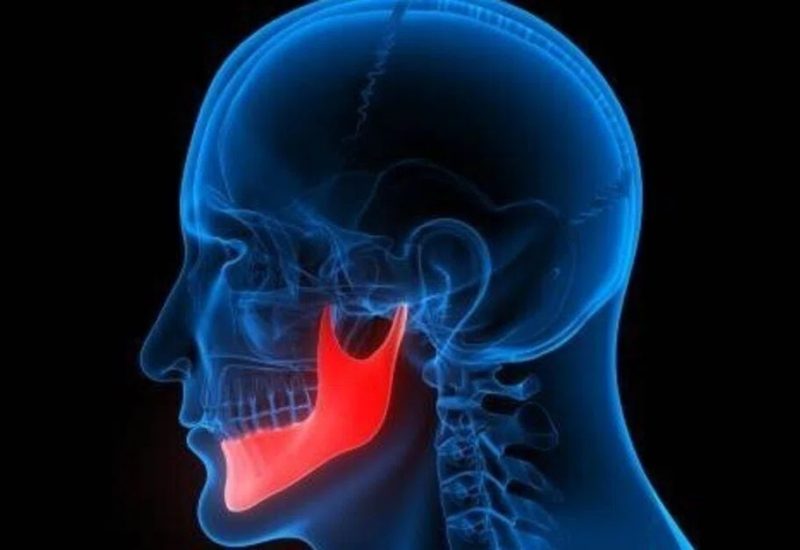 bruxismo-4.0 bruxismo-4.0