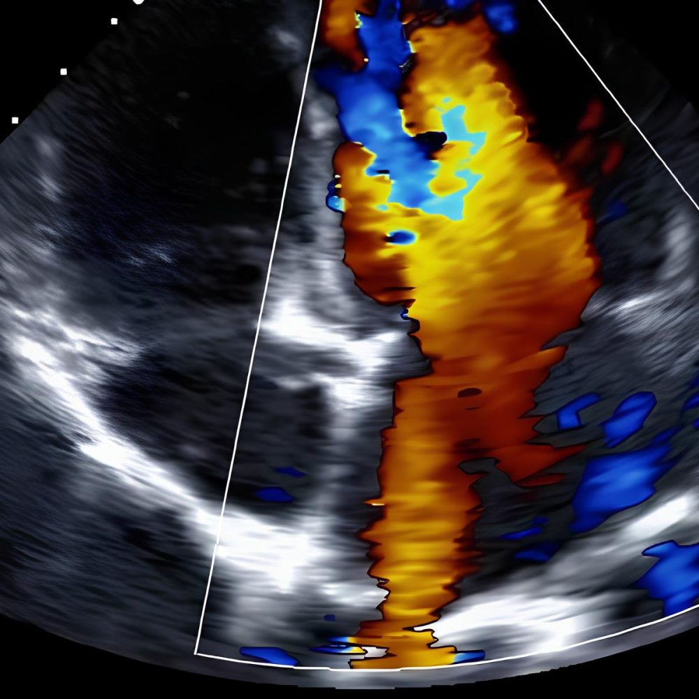 ECOCOLORDOPPLER DI INTERESSE NEFROLOGICO Per Medicina d’Urgenza, Medicina Interna, Nefrologia, Radiodiagnostica  Bari: 8 giugno 2024Roma: 22 giugno 2024 Milano: 13 luglio 2024
